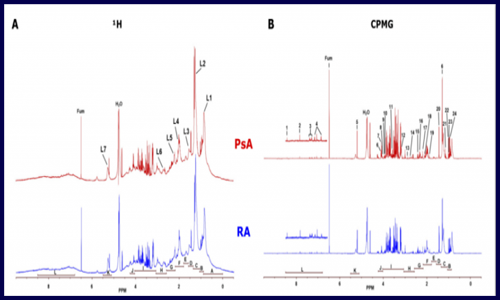 代謝組 | 利用代謝物和脂質(zhì)類差異來鑒定 negRA 和 PsA 潛在生物標(biāo)志物