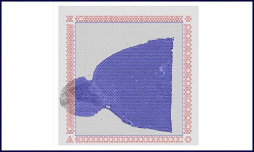 空間轉(zhuǎn)錄組 | 專業(yè)的 10x 空間轉(zhuǎn)錄組 summary 網(wǎng)頁(yè)報(bào)告解讀