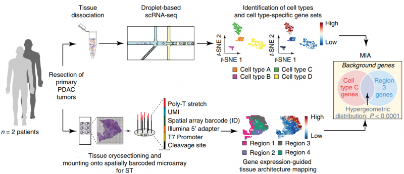 ST 聯(lián)合 scRNA 揭示胰腺導管癌組織細胞類型及結(jié)構(gòu)