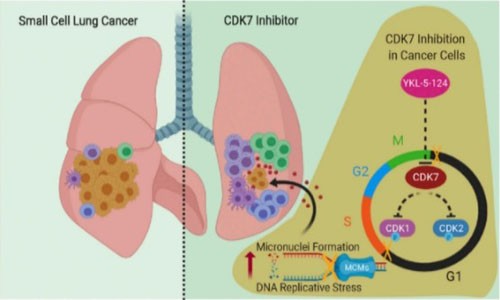 抑制 CDK7 表達破壞基因組復制進程，觸發(fā)抗腫瘤免疫反應