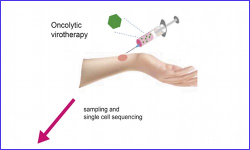 文獻解讀 | 應(yīng)用單細(xì)胞測序技術(shù)研究溶瘤病毒的治療作用機制
