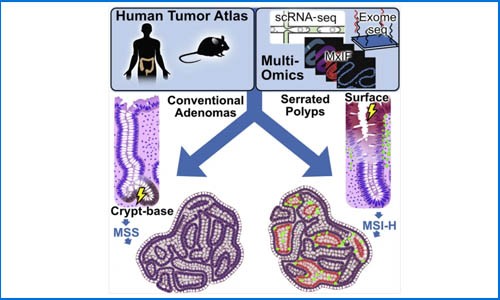 Cell 發(fā)表結直腸癌前病變多組學圖譜，揭示兩種常見結直腸息肉的不同癌變路徑