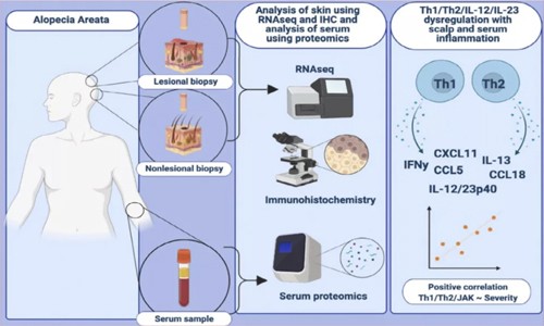Olink 科研文獻 | 血清標志物為實現(xiàn)斑禿無創(chuàng)診斷和靶向治療提供新希望