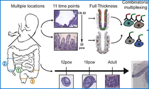 多組學聯(lián)合 | 單細胞測序聯(lián)合空間轉錄組繪制人類腸道時空發(fā)育圖譜