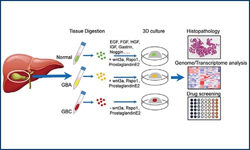 項(xiàng)目文章 | 伯豪生物單細(xì)胞測(cè)序分析助力類器官膽囊癌建模和藥物篩選