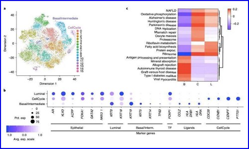 文獻(xiàn)解讀 | 單細(xì)胞測序研究人類前列腺癌