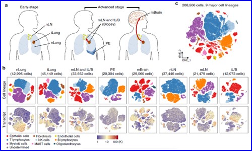 文獻解讀 | 單細胞測序技術，揭示轉移性肺腺癌的單細胞轉錄組圖譜