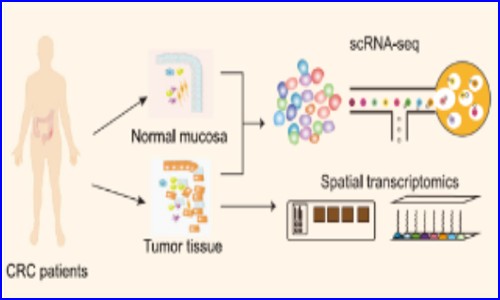 空轉(zhuǎn)實(shí)驗(yàn)文章 NC- 上海免疫所蘇冰 / 葉幼瓊團(tuán)隊(duì)揭示結(jié)直腸癌腫瘤邊界間質(zhì)細(xì)胞與巨噬細(xì)胞互作模式