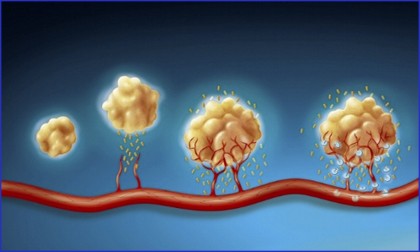 文章解析 |Cell 首次大規(guī)模高分辨率揭示從一個攜帶致癌突變的單細(xì)胞演變?yōu)榍忠u性腫瘤的全過程