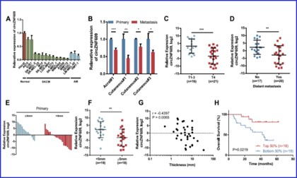 項目文章 | 伯豪生物 circRNA 測序助力在肢端和皮膚黑色素瘤的轉(zhuǎn)移中發(fā)揮重要作用的調(diào)控因子 --circZNF609