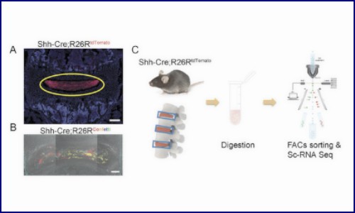 文獻解讀 | 鑒定和應(yīng)用髓核前體細胞治療椎間盤退變