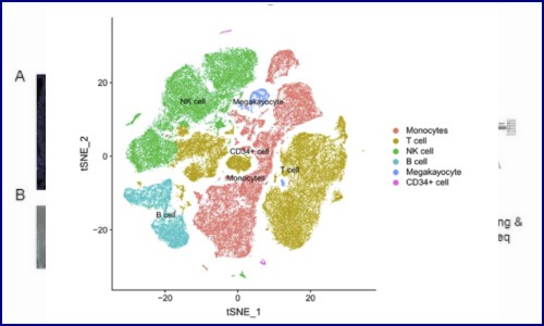 項目文章 | 單細胞 RNA 測序揭示急性心肌梗死的循環(huán)免疫圖譜
