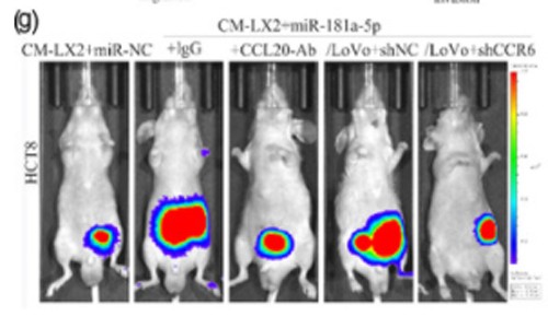 文獻(xiàn)解讀 |miRNA 芯片技術(shù)揭示細(xì)胞外囊泡 miRNA 促進(jìn)結(jié)直腸癌肝轉(zhuǎn)移新機(jī)制