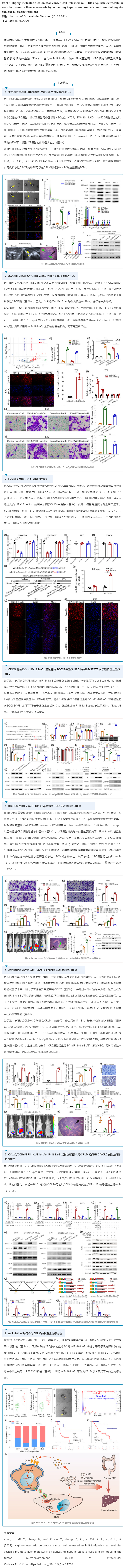 文獻解讀_miRNA 芯片技術揭示細胞外囊泡 miRNA 促進結(jié)直腸癌肝轉(zhuǎn)移新機制