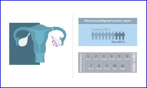 文獻解讀 | 運用 Olink 蛋白質(zhì)組發(fā)現(xiàn)生物標(biāo)志物組合加速卵巢癌無創(chuàng)早診