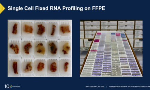 全方位解鎖 FFPE 樣本 |10x Genomics 單細(xì)胞 + 空間解決方案全方位解鎖 FFPE 樣本中蘊(yùn)含的寶貴信息