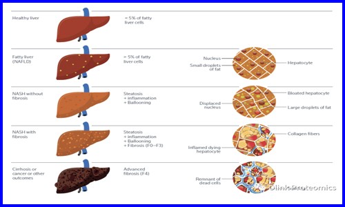 Nat Gen 干貨 |deCODE genetics 團(tuán)隊借助 Olink Explore 對 NAFLD 患者進(jìn)行多組學(xué)研究