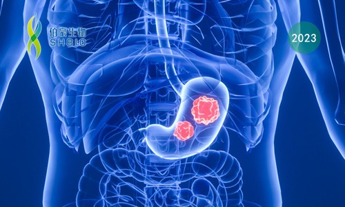 文獻(xiàn)解讀 | 胃癌患者免疫細(xì)胞的單細(xì)胞轉(zhuǎn)錄組測序