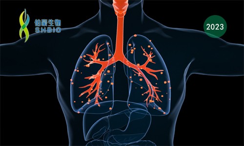 項(xiàng)目文章 | 張鵬 / 王晨飛合作揭示非小細(xì)胞肺癌的微環(huán)境在免疫治療中的動(dòng)態(tài)變化