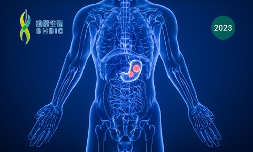 Cell 子刊 | 基于單細(xì)胞轉(zhuǎn)錄組測(cè)序數(shù)據(jù)，揭示胃腺癌進(jìn)展過(guò)程中免疫、基質(zhì)細(xì)胞狀態(tài)及生態(tài)型演變