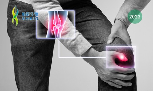 mRNA-seq 項(xiàng)目文章 | 靶向 KAT2A 通過(guò)表觀遺傳和代謝重編程抑制炎性巨噬細(xì)胞活化和類風(fēng)濕關(guān)節(jié)炎