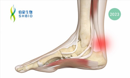 mRNA-seq 項(xiàng)目文章 | 高拉伸聚酯基壓電彈性體同時(shí)實(shí)現(xiàn)跟腱斷裂加速再生和運(yùn)動(dòng)監(jiān)測(cè)