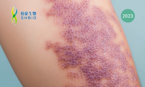 多組學(xué)聯(lián)合文章速遞 | 空間轉(zhuǎn)錄組 + 單細(xì)胞 + 蛋白組學(xué)共同揭示特應(yīng)性皮炎中復(fù)雜的炎癥細(xì)胞網(wǎng)絡(luò)