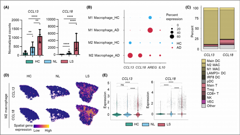 空間轉(zhuǎn)錄組測(cè)序 + 單細(xì)胞測(cè)序 + 蛋白組學(xué)測(cè)序 SCI 文章圖 3