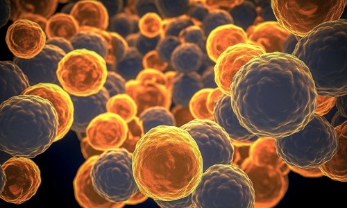 文獻(xiàn)解讀 | 具有細(xì)胞毒性潛能的腫瘤駐留 T 細(xì)胞與頭頸癌患者的新輔助抗 PD- 1 反應(yīng)有關(guān)