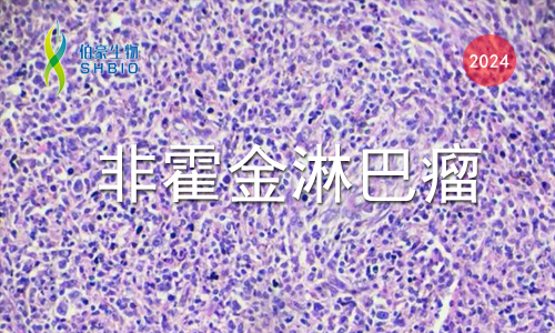 文獻(xiàn)解讀 | PD- 1 在 T 細(xì)胞淋巴瘤中相關(guān)抑制代謝程序，限制糖酵解和抑制 AP- 1 活性