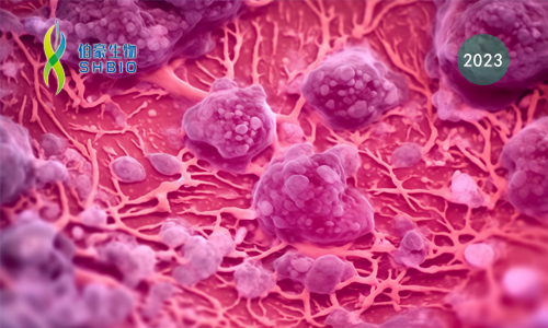 文獻(xiàn)解讀 | MFN2 介導(dǎo)的線粒體 - 內(nèi)質(zhì)網(wǎng)接觸通過維持線粒體鈣穩(wěn)態(tài)增強(qiáng) CD8+ T 細(xì)胞在腫瘤微環(huán)境中的代謝適應(yīng)和效應(yīng)功能