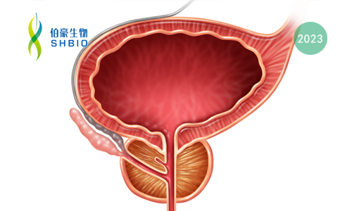 文獻解讀 | 在肺癌和前列腺癌中，通過下調(diào) SOX2 抑制 Exportin 1 從而抑制神經(jīng)內(nèi)分泌轉化
