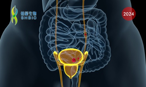 Nat Med 臨床 II 期案例 |Olink 蛋白組學(xué)助力膀胱癌患者分層以推進(jìn)精準(zhǔn)診療
