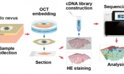 項目文章 | 暈痣黑色素細胞代謝異常與樹突狀細胞活化有關