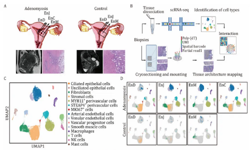 文獻解讀 | 整合單細胞 RNA 測序和空間轉(zhuǎn)錄組學(xué)破譯人類子宮腺肌癥的全面轉(zhuǎn)錄圖譜