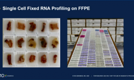 技術突破 | FFPE 樣本產(chǎn)出高質(zhì)量單細胞數(shù)據(jù)的秘籍