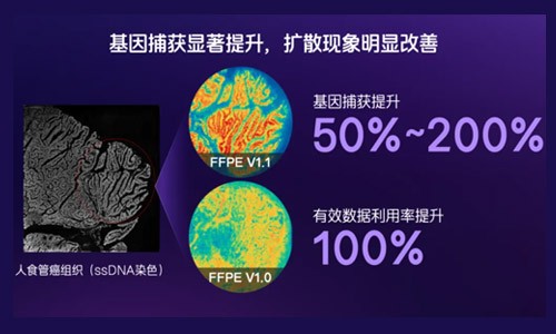 臨床科研新利器！納米級時空轉(zhuǎn)錄組 FFPE V1.1 預(yù)售啟動，解鎖研究新可能